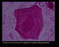 streptococcus pneumoniae appearance in sputum